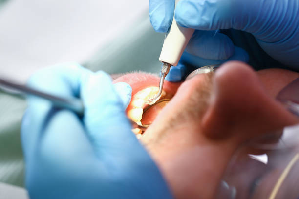 Best Cosmetic Emergency Dentistry in Peotone, IL
