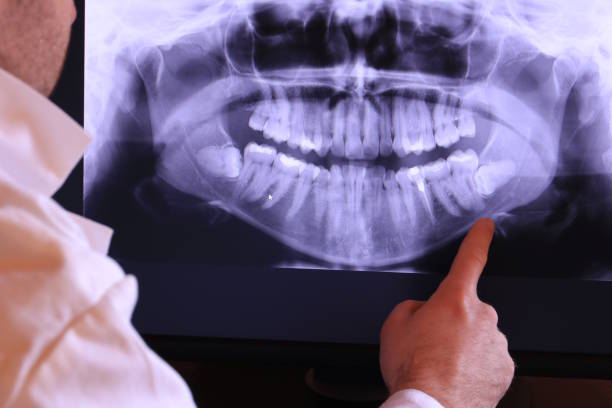 Best Weekend Emergency Dentist in Peotone, IL